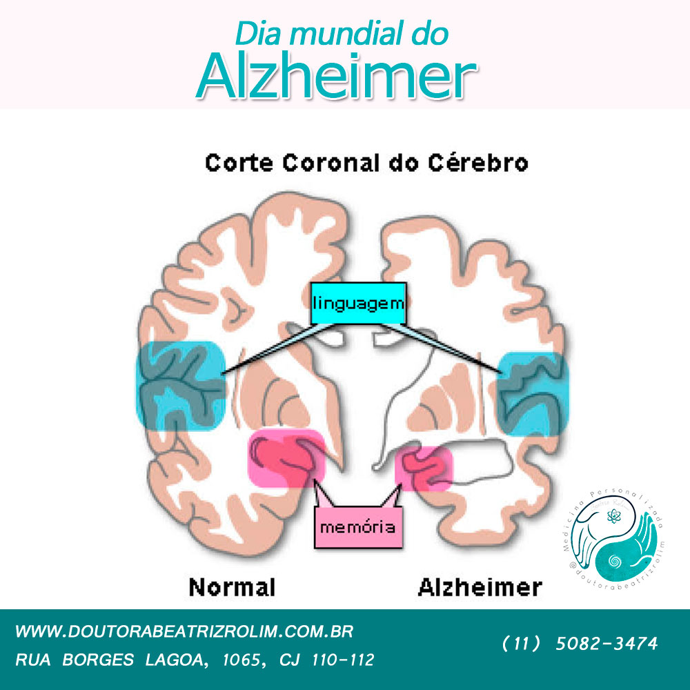 Dia Mundial do Alzheimer