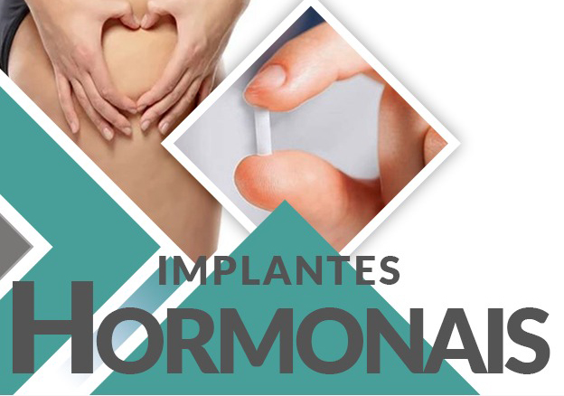 implantes-hormonais